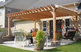 Pergolas,  Cumming, GA Pergolas,  Cumming, GA